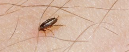 벼룩 물린 자국1