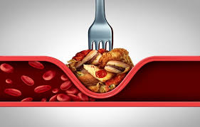 아마씨 효능 5가지와 부작용, 먹는법 아마씨유, 가루