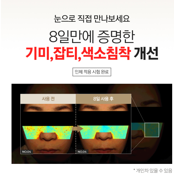 베리홉 미백앰플 8일 효과