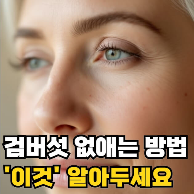 검버섯 없애는 방법