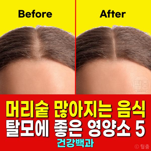 머리숱 많아지는 음식 탈모에 좋은 영양소