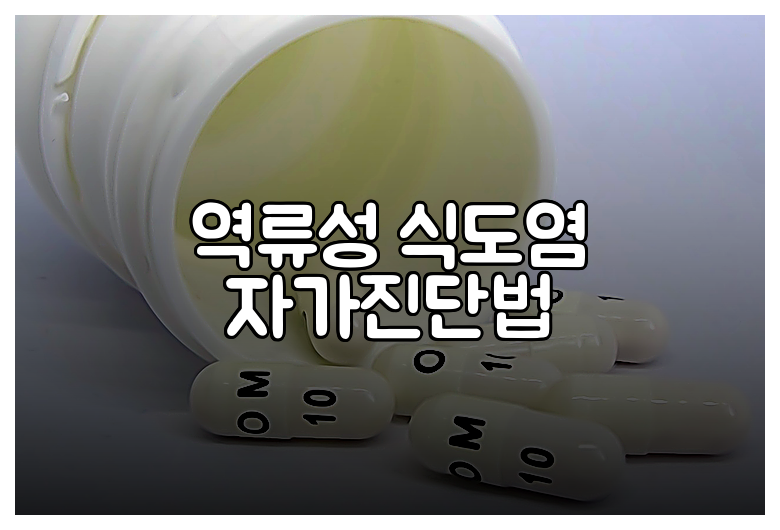 역류성 식도염 자가진단법