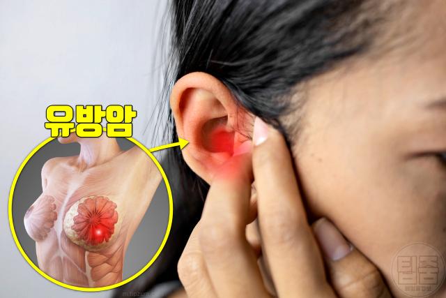 귀 건강 유방암 귀지 폐경 이명 돌기 신장 귓불주름 심장