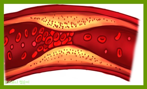 혈관 건강 사진