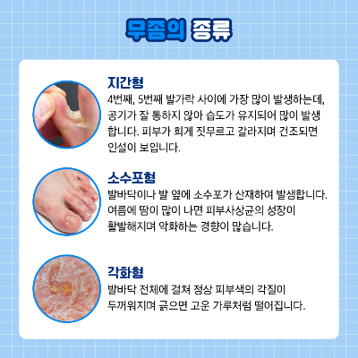 무좀의 종류