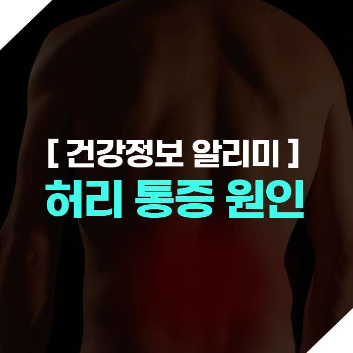 허리 통증의 원인, 질환별 대처 방법은?