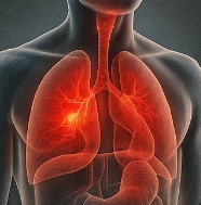 염증에 좋은 음식