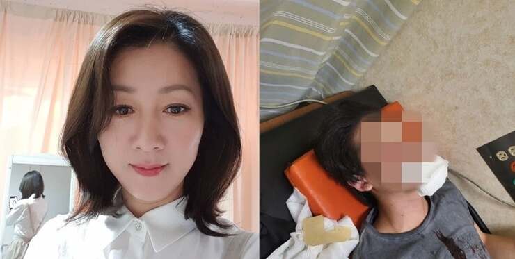 방은희 아들 사고&#44; 수술 소식 &quot;왜 이런 시련이...&quot;