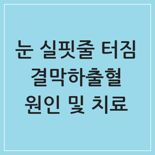 눈 실핏줄 터짐 결막하출혈: 원인과 치료법, 충혈과의 차이점 알아보기