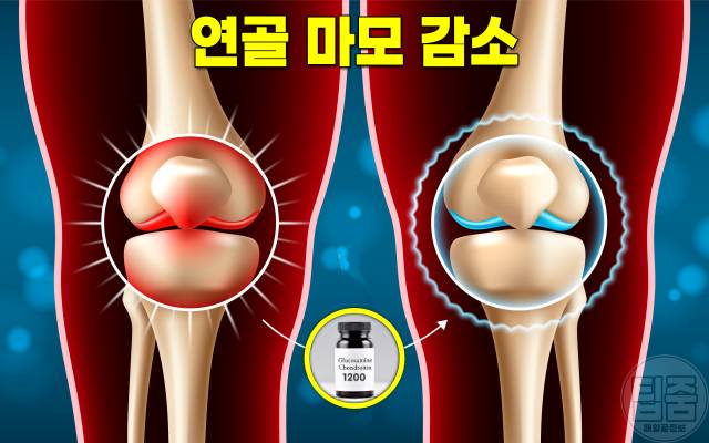 관절영양제 콘드로이친 효능 부작용 권장량 글루코사민 차이