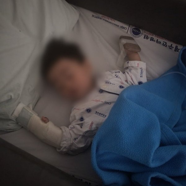 제주 동물원 토끼 손가락 절단