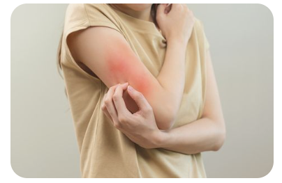 피부-가려움증-원인