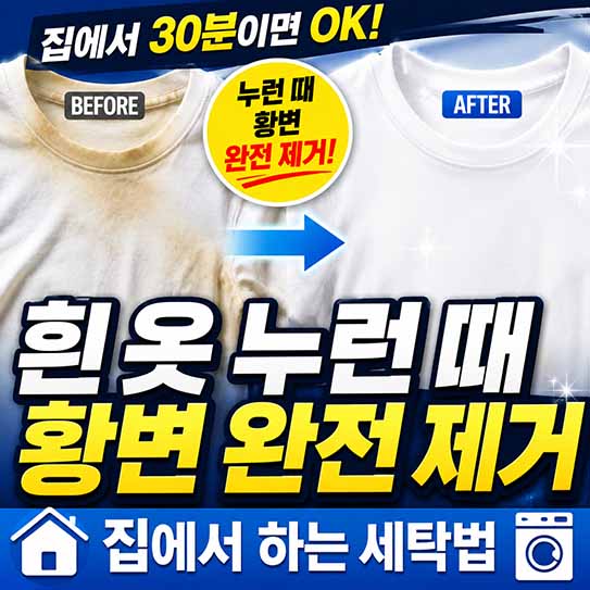 흰 옷 누런 때 황변 완전 제거하는 집에서 하는 세탁법