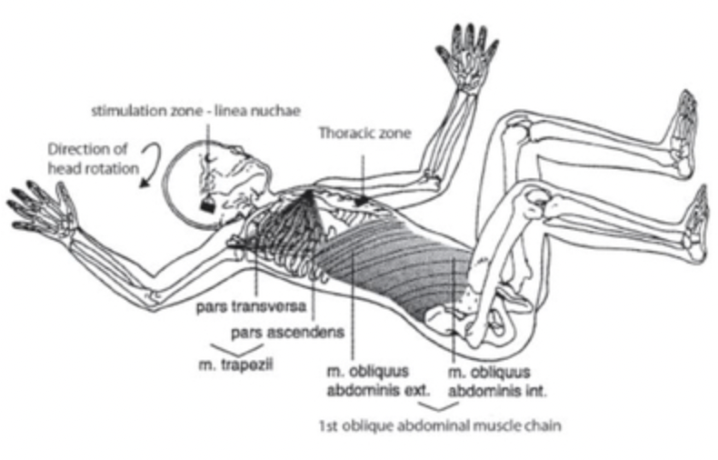 보이타치료와 뇌성마비