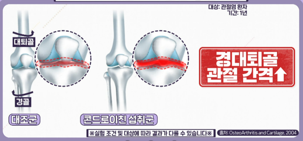 콘드로이친