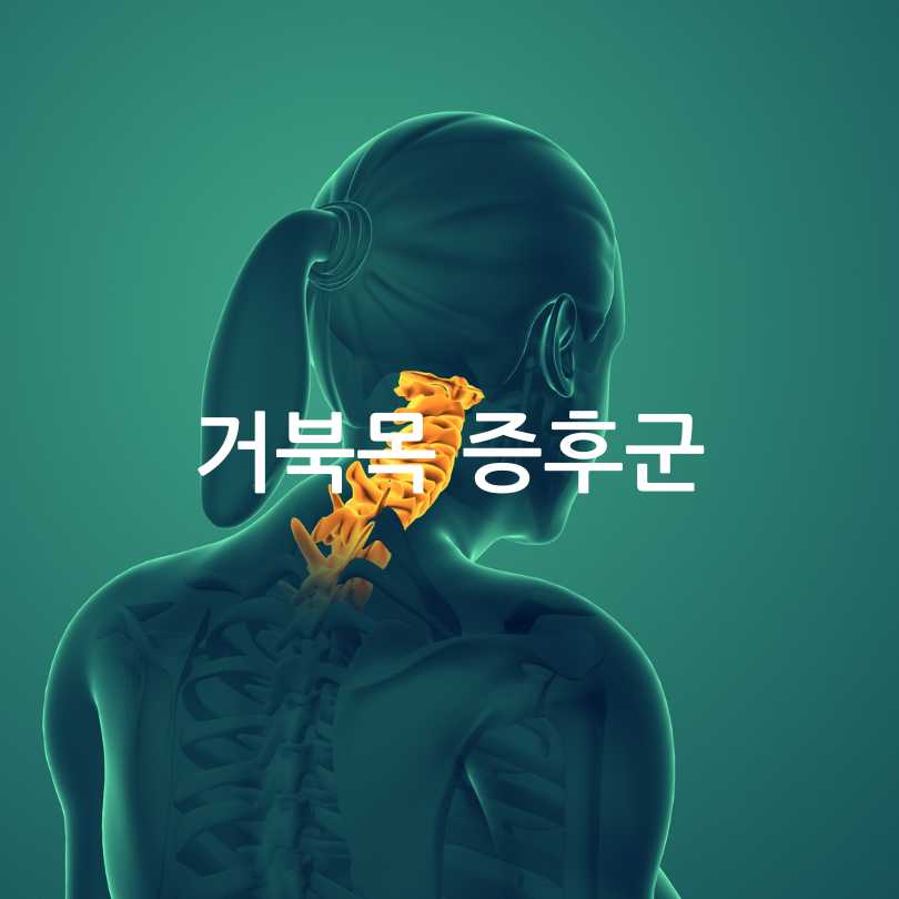 거북목 증후군