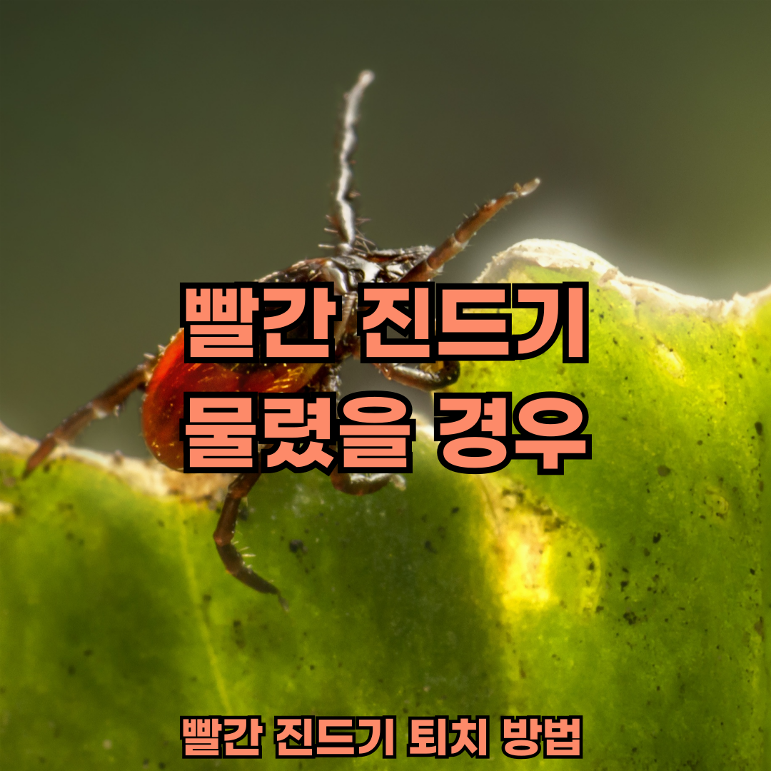 빨간진드기 물렸다