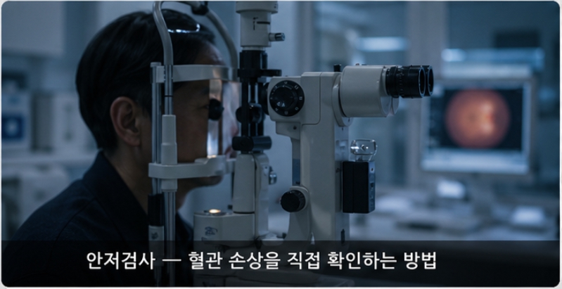 혈압 수치와 눈 손상의 관계