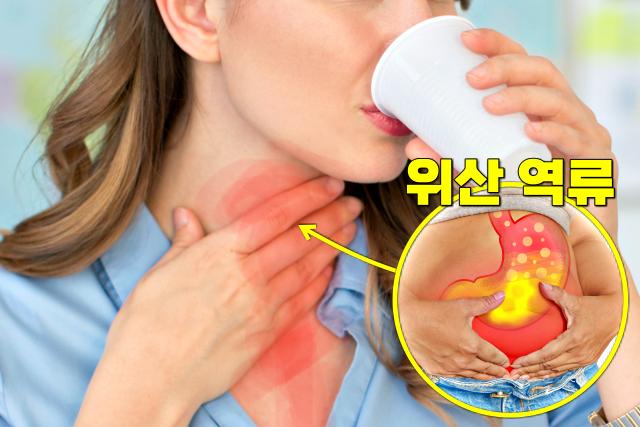 입이 마르는 이유, 위산 역류 증상, 팁줌