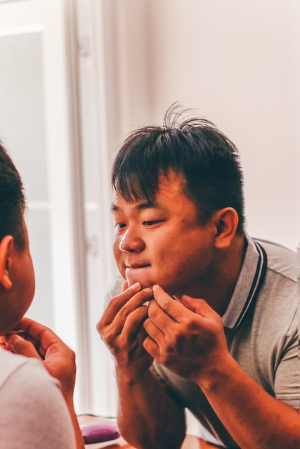 여드름 연고 일반의약품 애크논크림 애크린겔