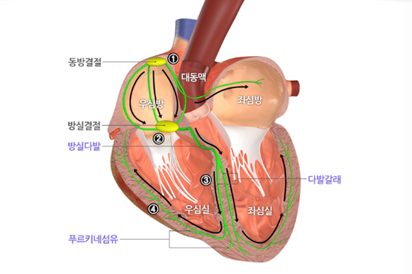 심장리듬 부정맥 의심과 발생하는 원인