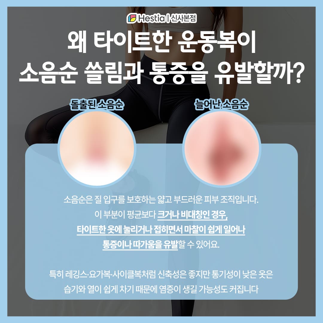 왜 타이트한 운동복이 소음순 쓸림과 통증을 유발할까?