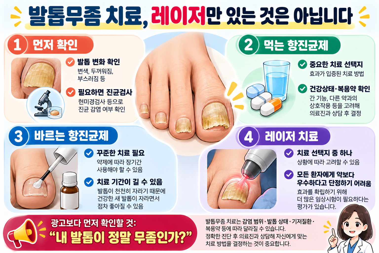 발톱무좀의 진균검사와 먹는 항진균제 바르는 항진균제 레이저 치료의 차이를 설명하는 인포그래픽