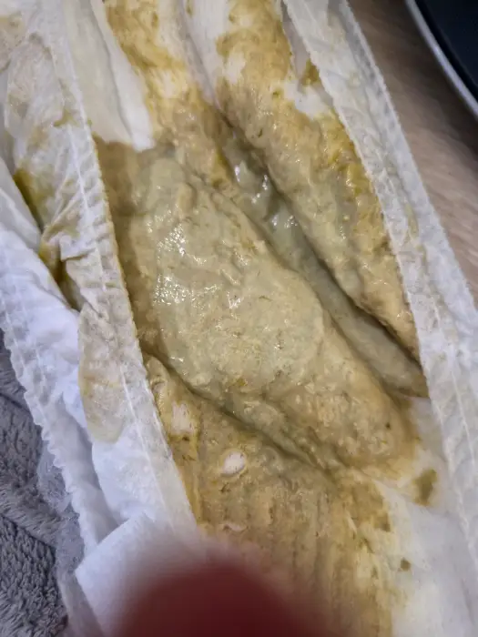 물설사 시작할때 아이 변