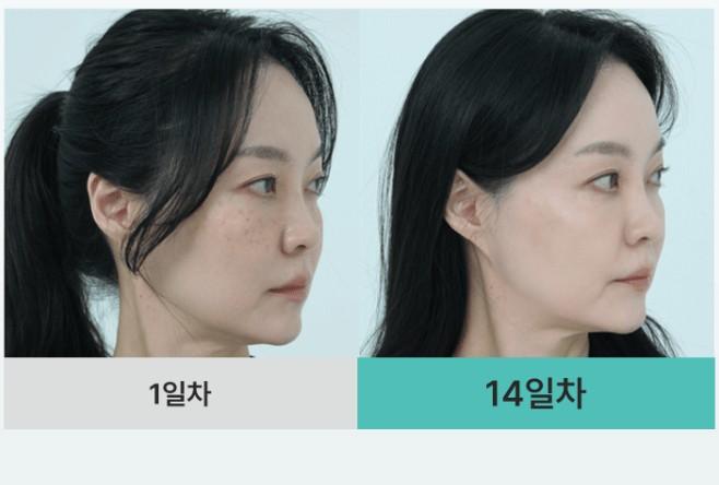 멜라케어 필크림 마스크 후기