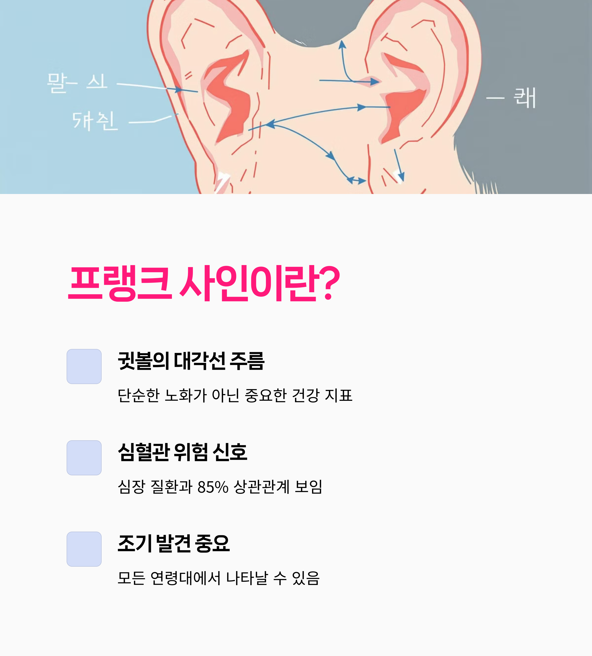 귀주름