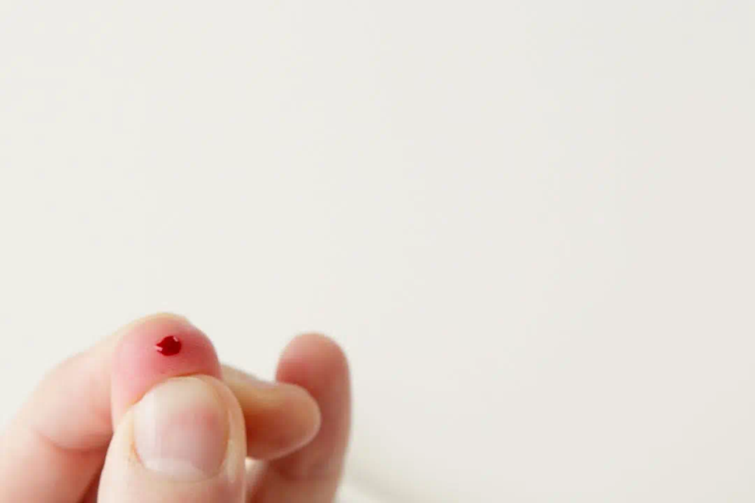 당뇨 혈당치료 관련사진9