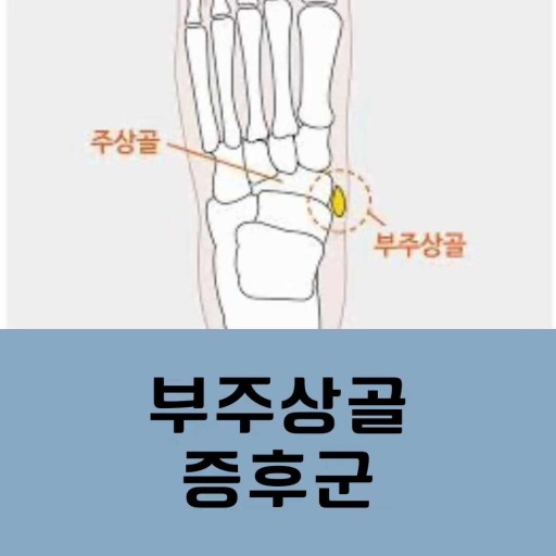 부주상골 위치