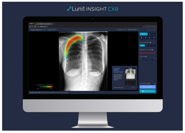 루닛은 영상 판독 AI에서 독보적인 기술력을 보유하고있다.