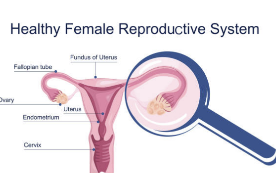 자궁근종 증상 수술후 회복기간 수술비용 좋은음식 등 총정리(최신)