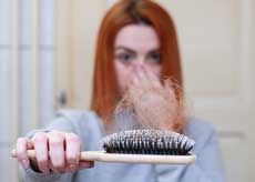 미녹시딜 부작용&amp;#44; 여자&amp;#44; 사용방법&amp;#44; 가격&amp;#44; 직구