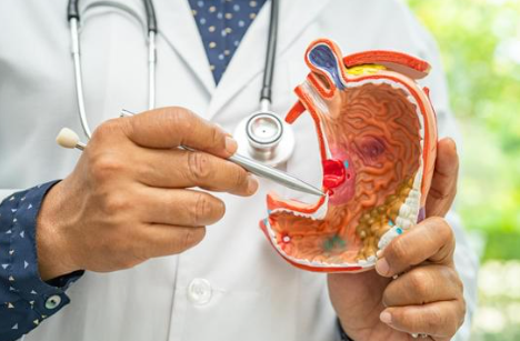 위궤양에 좋은 음식 증상 원인 치료 관리방법