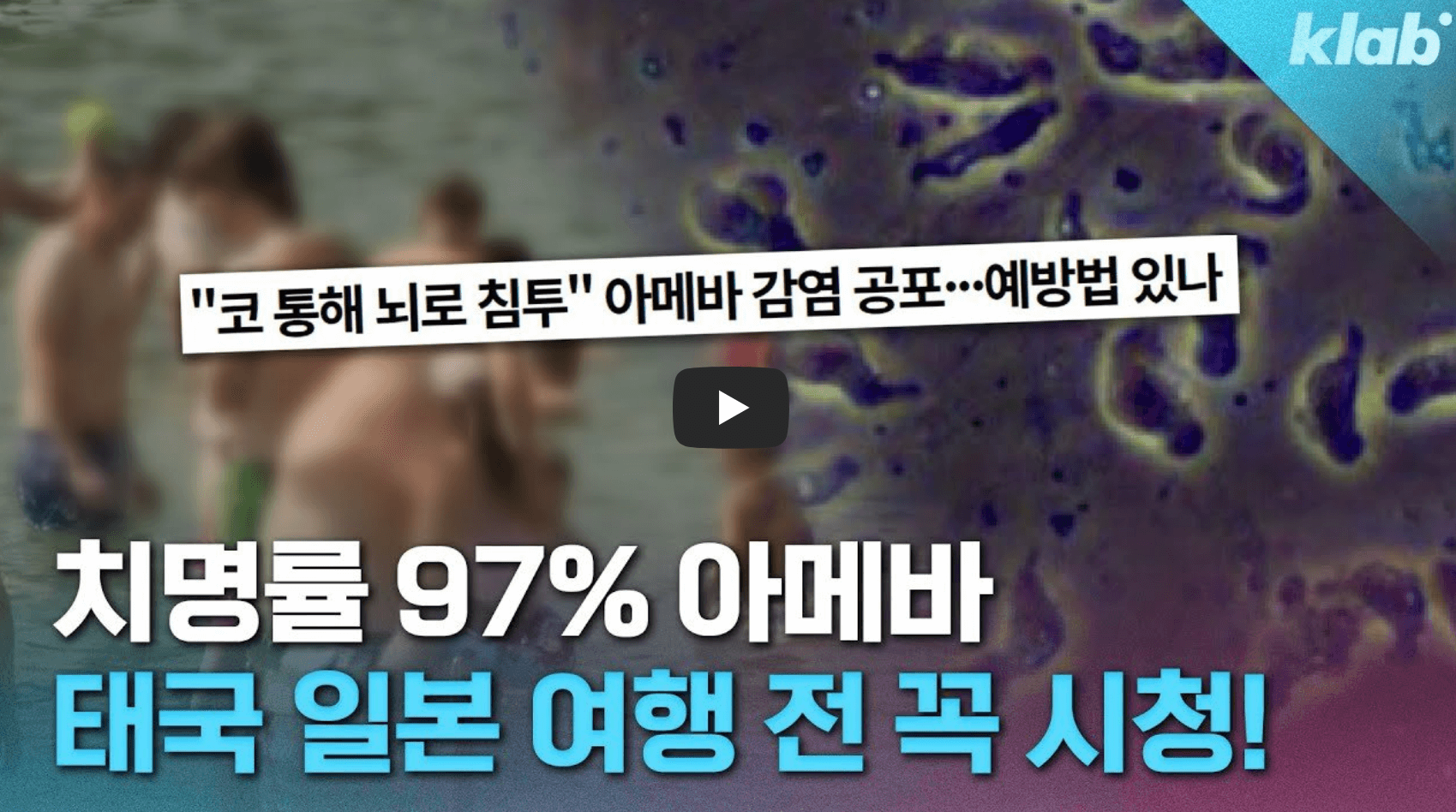 미국 뇌먹는 아메바 예방법