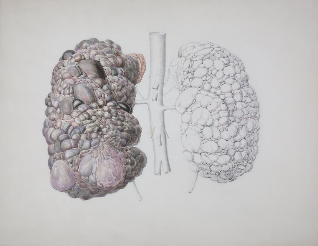 Lung cancer