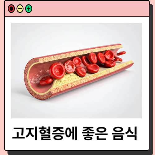 고지혈증에 좋은 음식