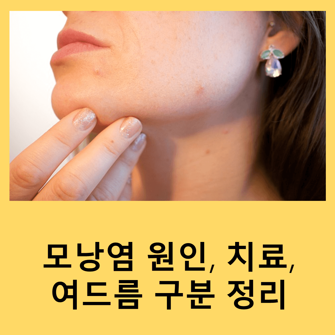 모낭염