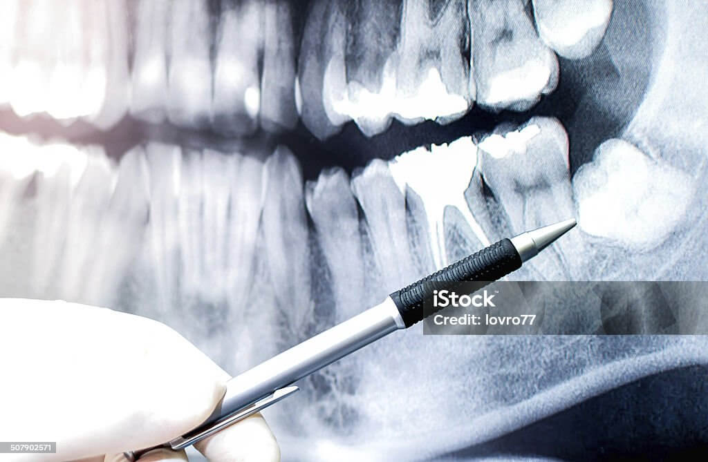 건성 소켓의 예방법 및 증상