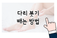 이 배너를 클릭하시면 다리가 붓는 이유와 붓기 빼는 법 게시물로 이동 됩니다.