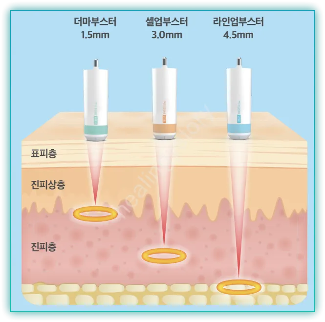 부스터카트리지