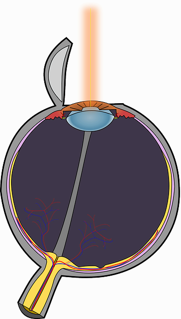 비문증 치료방법 수술 레이저 치료 장단점
