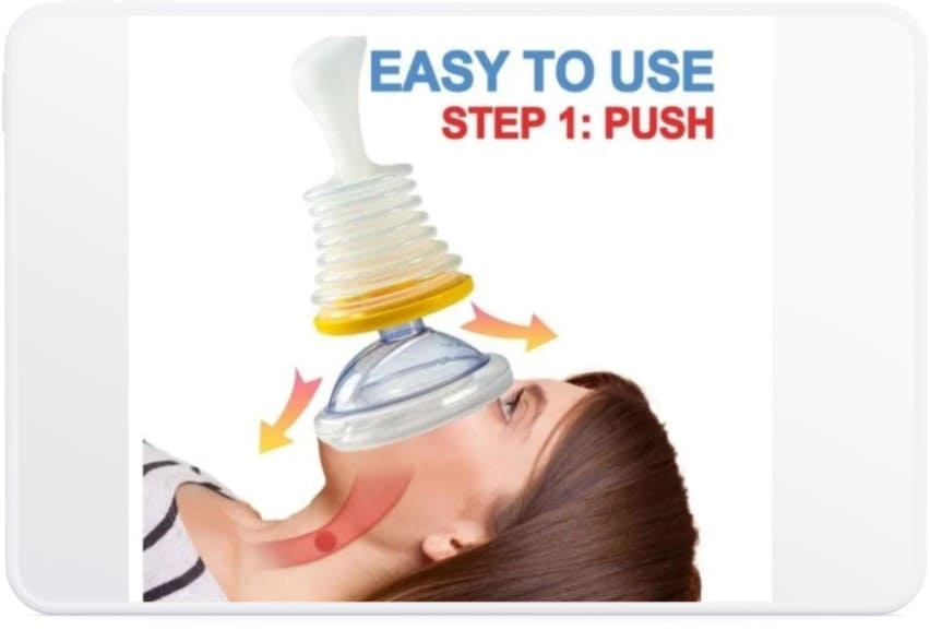 하임리히법-키트