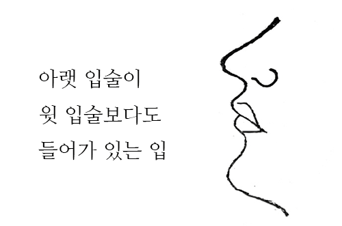 아랫 입술이 웃 입술보다 들어간 얼굴