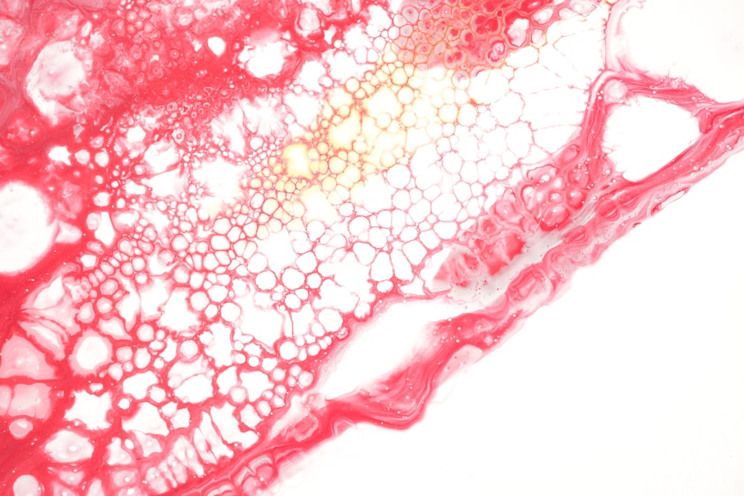ulcer