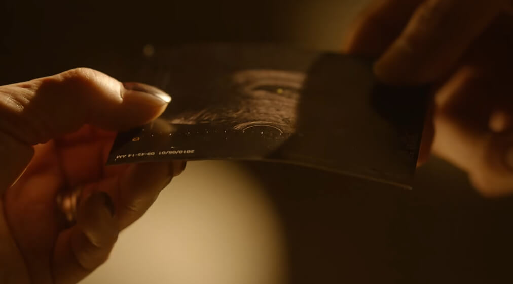 아기 초음파 사진