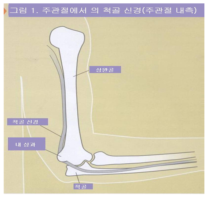 척골 신경 압박 증후군 출처: 대한 정형외과 학회 홈페이지