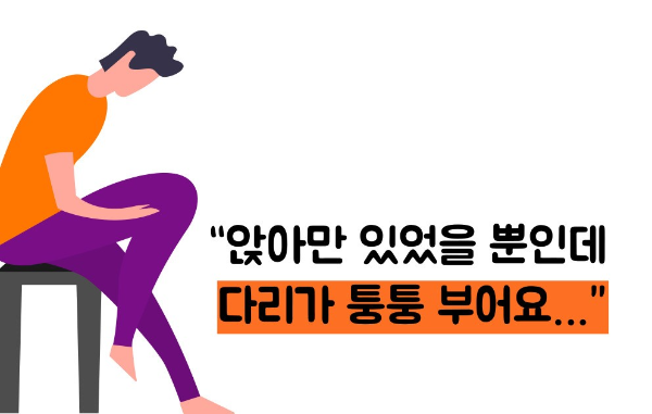 하지 정맥류 증상